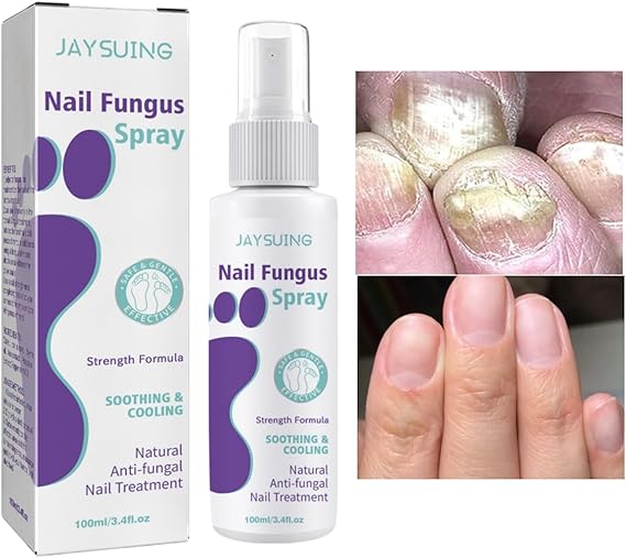 JAYSUING Nail Fungus Spray