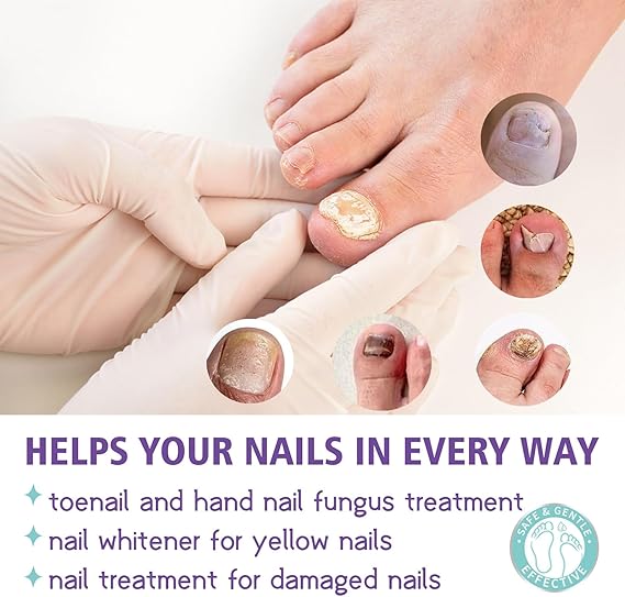 JAYSUING Nail Fungus Spray