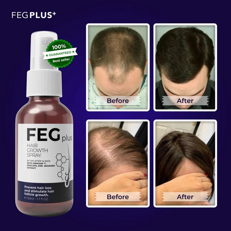 FEG Plus Natural Hair Growth Spray: Nourish Your Scalp for Lush, Vibrant Hair