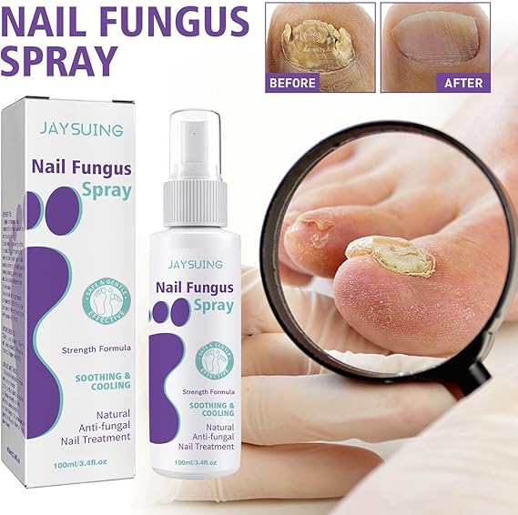 JAYSUING Nail Fungus Spray