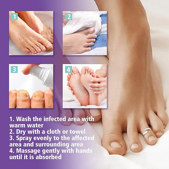 JAYSUING Nail Fungus Spray
