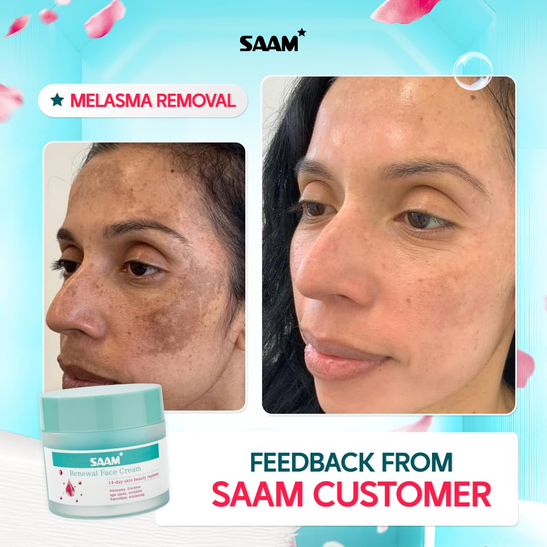SAAM Face Cream for Melasma, Freckles & Dark Spots