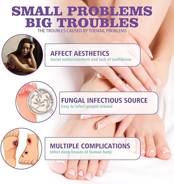 JAYSUING Nail Fungus Spray