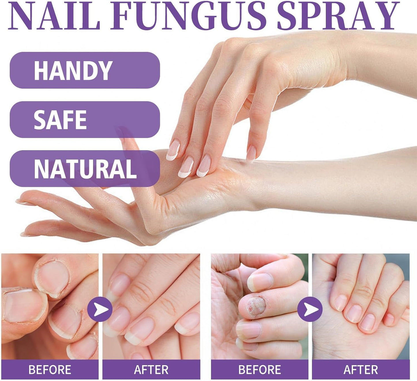 JAYSUING Nail Fungus Spray