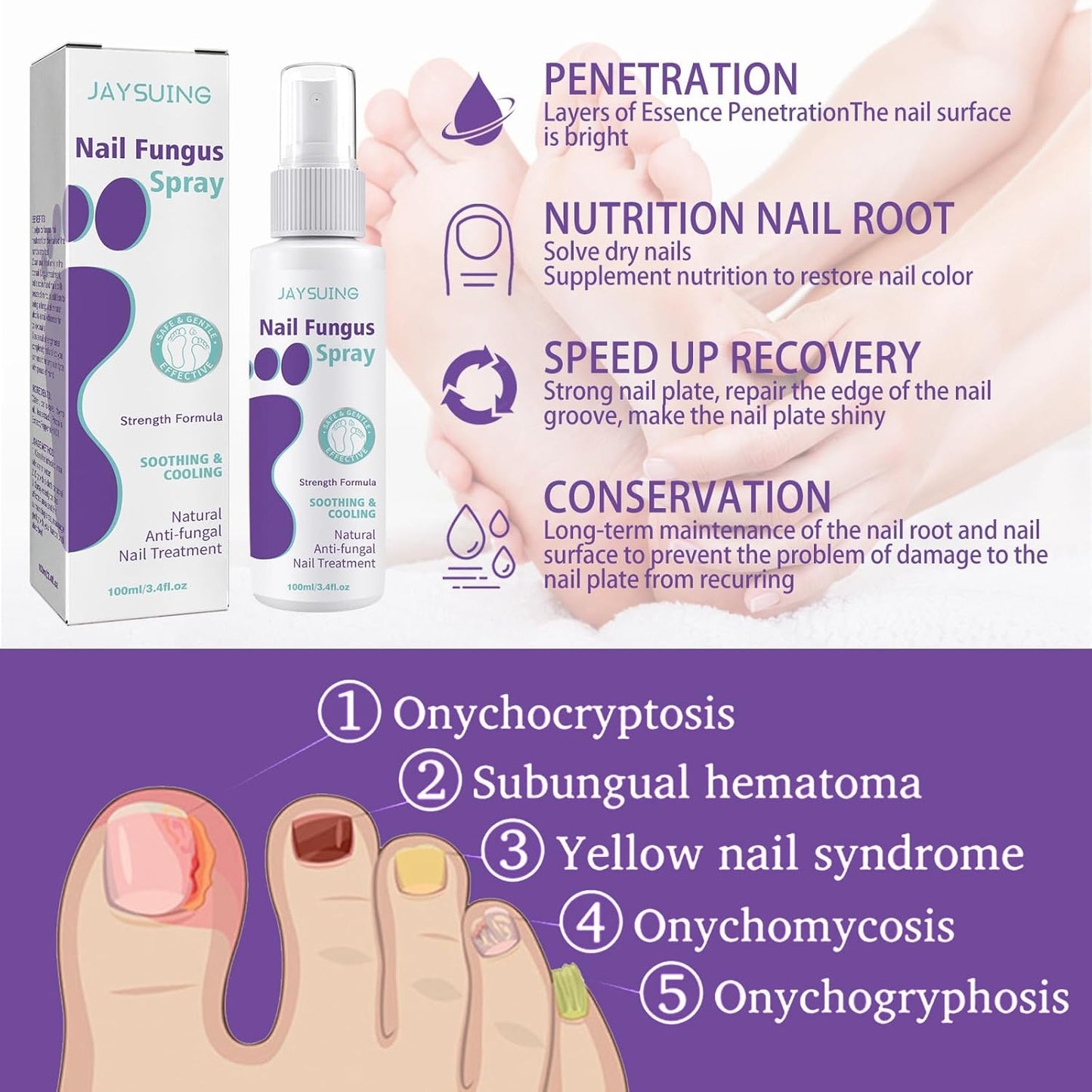 JAYSUING Nail Fungus Spray