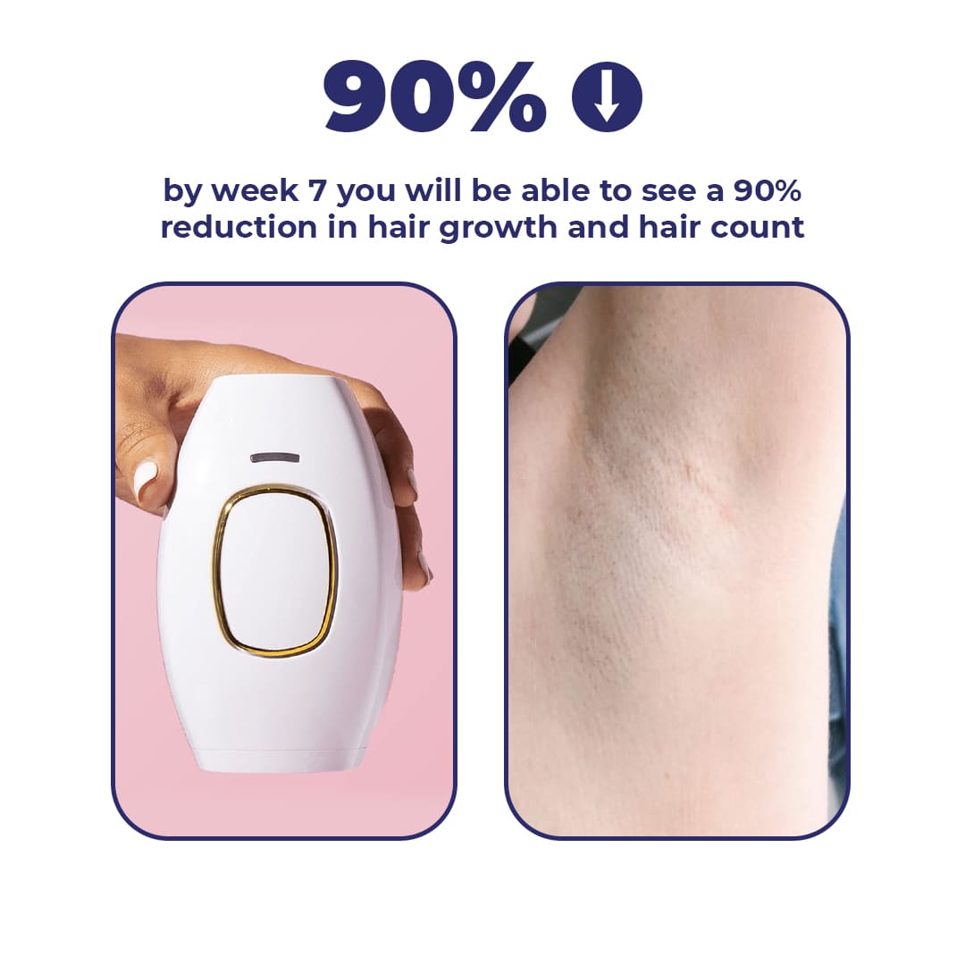 IPL LASER HAIR REMOVAL : Mini Laser Hair Removal