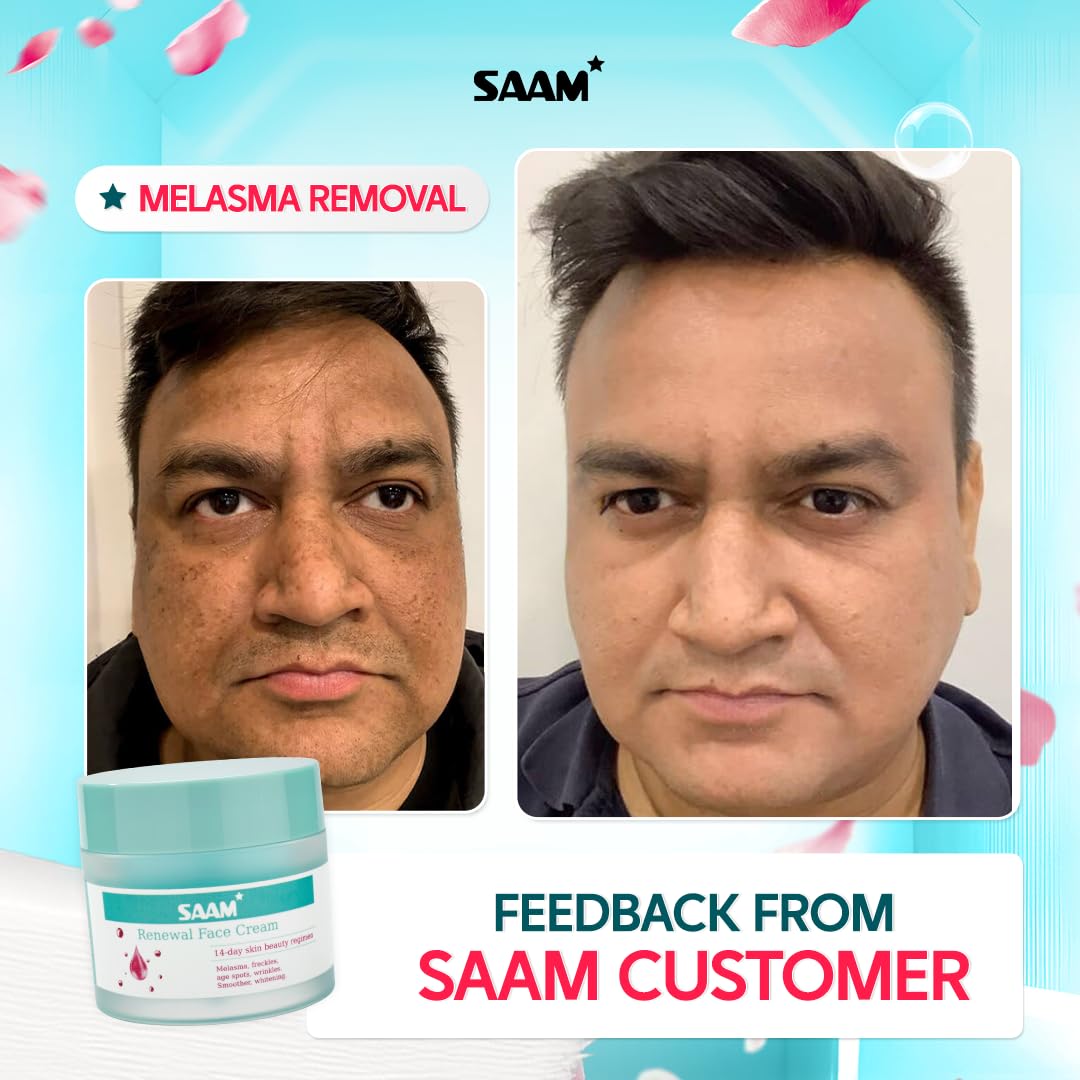 SAAM Face Cream for Melasma, Freckles & Dark Spots