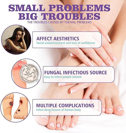 JAYSUING Nail Fungus Spray