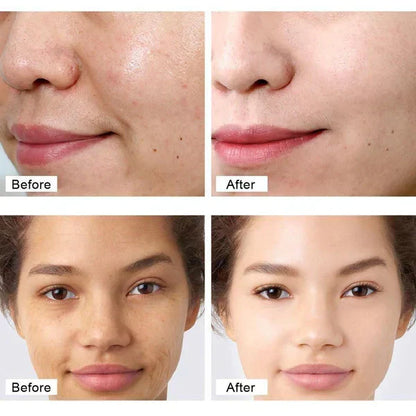 Retinol Cream Skin Lightening Anti Wrinkl