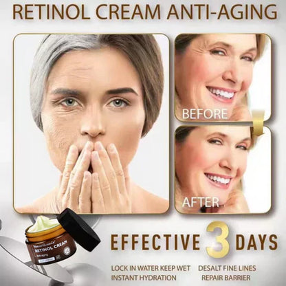 Retinol Cream Skin Lightening Anti Wrinkl